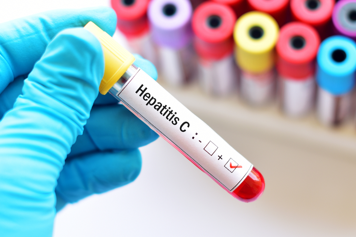 Hər il dünyada 1,4 milyon adam hepatitdən vəfat edir