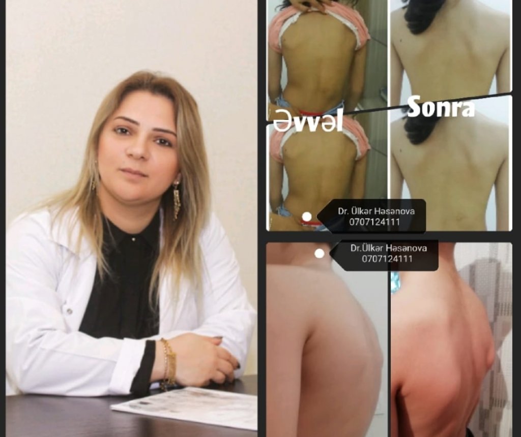 Dr. Ülkər Həsənova pasientlər üçün yenilik etdi