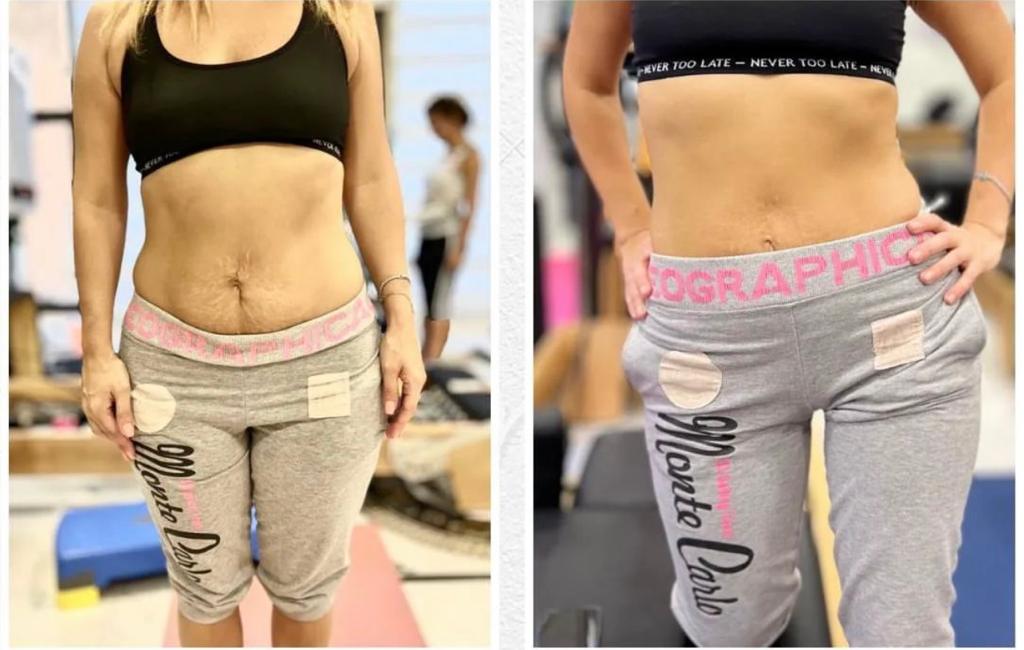 Pilates Könül : "Mən bu peşəni hər yaşda sevmişəm"