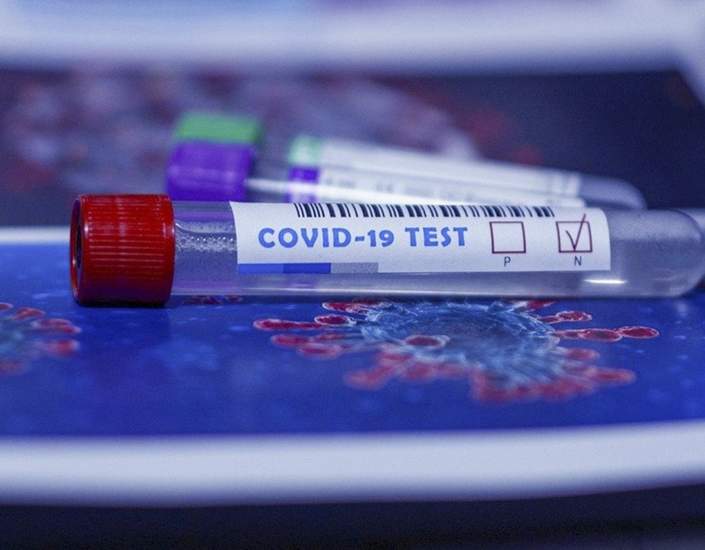 SN: Sərt karantin tədbirlərinə ehtiyac yoxdur, epidemioloji vəziyyət stabildir