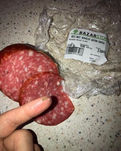 "Bazarstor"dan aldığı kolbasanın içindən şüşə çıxdı – FOTO "Bazarstor"dan aldığı kolbasanın içindən şüşə çıxdı – FOTO